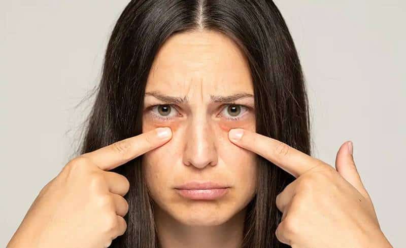 한 여성의 양쪽 눈 아래가 붓는 듯한 모습을 손가락으로 가리키며 걱정스러운 표정을 짓고 있는 모습으로, 한쪽만 붓는 경우와 양쪽이 동시에 붓는 경우의 차이를 설명하는 데 활용되는 이미지.