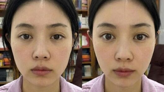 얼굴이 부어 보이는 상태와 비교 후 모습이 나란히 보이는 사진으로, 몸이 자꾸 부으면서 얼굴에도 나타나는 변화를 설명하는 이미지.